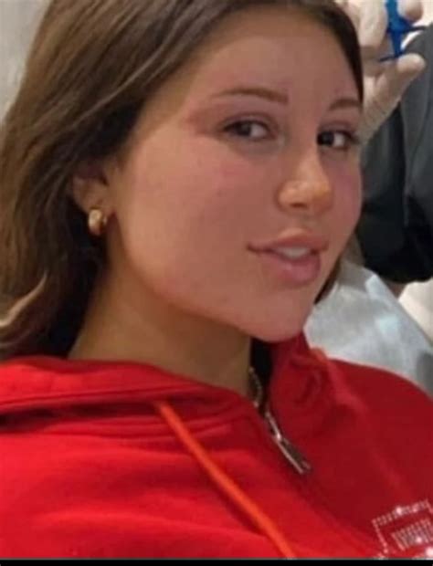 While her photos before surgery could have been found earlier, Testa decided to stay away from the hate comments and close her account. . Mikaela testa before surgery